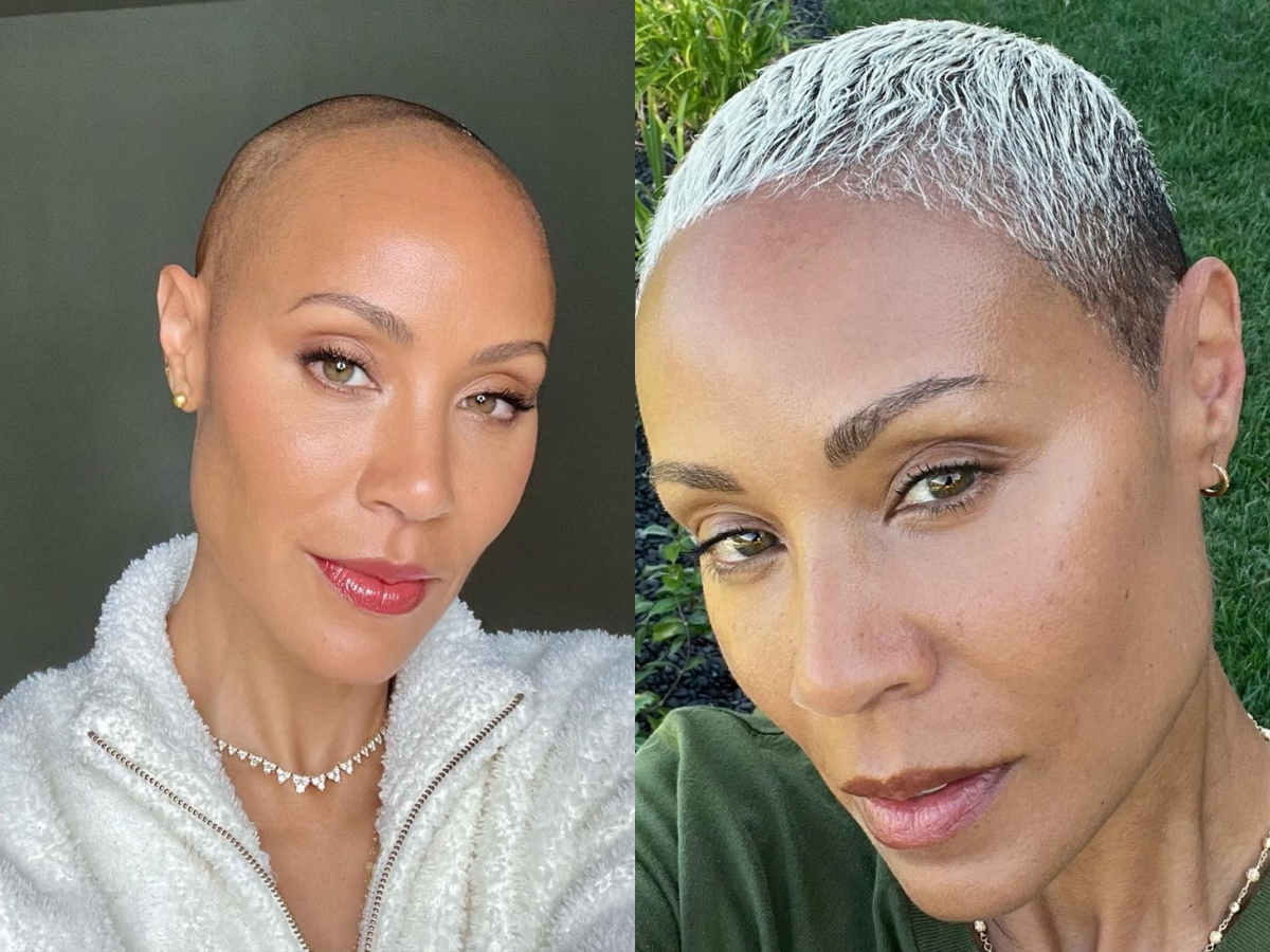Jada Pinkett Smith Shares Update on Alopecia Battle, Hair Starting to Grow Back